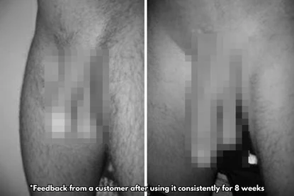 Customer feedback after 8 weeks of consistent use showing before and after results